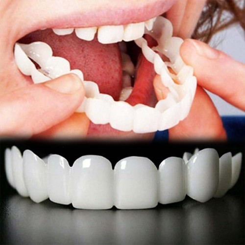 Snap veneers for missing - veneers,